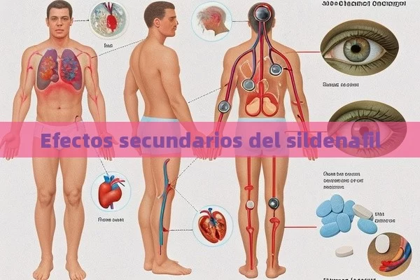 Efectos secundarios del sildenafil